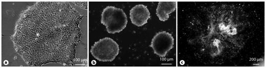 Fig. 2. hiPSC colonies (a) differentiate spontaneously to form EBs (b) and multicellular outgrowths (c).