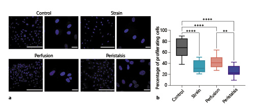 Ki67 immunofluorescent staining of hMSCs exposed to mechanical stimuli. a Representative fluorescence micrographs of hMSCs stained with Ki67 antigen (red fluorescence) and counterstained with nuclear marker, DAPI (blue fluorescence) from four conditions – control (static), strain, perfusion, and peristalsis. Scale bars, 200 or 20 µm. hMSCs were maintained as static controls, or exposed to 24 h of mechanical stimulation in the bioreactor with patterns of perfusion, strain, or peristalsis. b Box and whisker plots of percentage of proliferating cells for each condition. The percentage of proliferating cells was determined by manual counting of Ki67+ nuclei, compared to all nuclei present in the field of view. Statistical significance is indicated following one-way ANOVA analysis, with ****p< 0.0001 and **p< 0.001 between conditions. hMSCs subject to peristalsis demonstrated significantly lower proliferation compared to static controls, or perfusion conditions.
