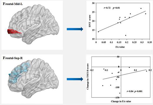 Correlation analysis between FA values in ROI and cognitive scores in real group. Frontal-Mid-L, left middle frontal gyrus; Frontal-Sup-R, right superior frontal gyrus; FA, fractional anisotropy; BNT, Boston Naming Test; TMT-B Test, Trail Making Test.