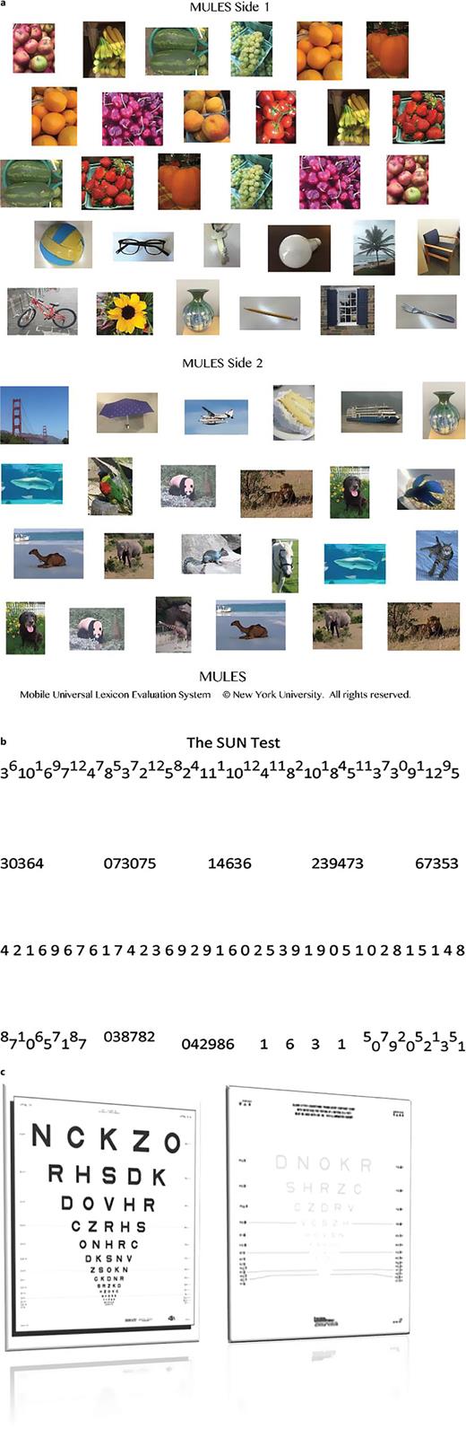 Binocular visual tests. a The Mobile Universal Lexicon Evaluation System (MULES) is a rapid picture-naming test (MULES test © New York University, text and photographs, registration number: TXu002026665; all rights reserved). It consists of a double-sided, laminated 8.5 × 11-inch sheet featuring 54 color photographs of fruits, objects, and animals in context. b The Staggered Uneven Number (SUN) test is a novel rapid number-naming task (SUN test © 2019 New York University; all rights reserved). It is a single-sided 8.5 × 11-inch sheet with 145 single- and double-digit numbers arranged in zigzag or horizontal patterns with varying spacing. Participants are instructed to read aloud each picture or number as quickly and accurately as possible, starting from the top left row and continuing across all subsequent rows. c LCLA chart is a specialized tool used to assess the ability to see details under conditions of reduced contrast, which can reveal visual impairments that are not detected by standard high contrast charts. Unlike conventional charts that use high-contrast letters (like those on the Snellen chart), low-contrast charts use letters, numbers, or symbols that are in shades of gray and have less contrast with their background, making them more challenging to identify.