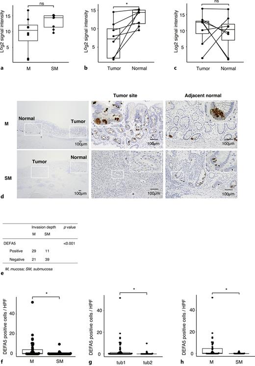 Downregulation of DEFA5 in early submucosal-invasive gastric cancer. a The expression level of DEFA5 in the normal mucosa of intramucosal gastric cancer (IMGC) (n = 8) and early submucosal-invasive gastric cancer (SMGC) (n = 8). Dot and box plots are shown. M and SM indicate IMGC and SMGC, respectively. The horizontal line in the middle of each box indicates the median, and the top and bottom borders of the box mark the 75th and 25th percentiles, respectively. Ns, not significant. b, c The expression levels of DEFA5 in the paired tumor site (n = 8) and normal mucosa (n = 8) of SMGCs (b) and IMGCs (c). Dot and box plots are shown. The horizontal line in the middle of each box indicates the median, and the top and bottom borders of the box mark the 75th and 25th percentiles, respectively. *p < 0.05. Ns, not significant. d Representative images of immunohistochemical (IHC) staining for DEFA5 in an IMGC and a SMGC. M and SM indicate IMGC and SMGC, respectively. Scale bar = 100 μm. e The number of DEFA5-positive and -negative cases of IMGCs and SMGCs. f Dot and box plot for the DEFA5-positive cells in IMGCs (n = 50) and SMGCs (n = 50). M and SM indicate IMGC and SMGC, respectively. The horizontal line in the middle of each box indicates the median, and the top and bottom borders of the box mark the 75th and 25th percentiles, respectively. *p < 0.05. g Dot and box plot for the DEFA5-positive cells in well differentiated (tub1) (n = 73) and moderately differentiated (tub2) (n = 27) tumors. The horizontal line in the middle of each box indicates the median, and the top and bottom borders of the box mark the 75th and 25th percentiles, respectively. *p < 0.05. h Dot and box plot for the DEFA5-positive cells in IMGCs with tub1 (n = 47) and SMGCs with tub1 (n = 26). M and SM indicate IMGC and SMGC, respectively. The horizontal line in the middle of each box indicates the median, and the top and bottom borders of the box mark the 75th and 25th percentiles, respectively. *p < 0.05.