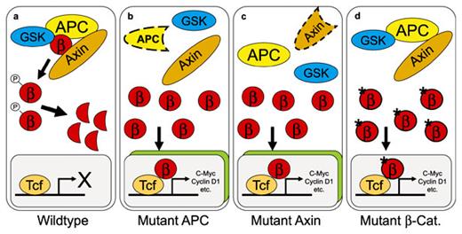 Deregulation of Wnt signaling in gastrointestinal tumors. a Under physiological conditions free β-catenin (β) is rapidly degraded. Three different mechanisms can lead to deregulation of Wnt/β-catenin/Tcf signaling. Inactivation of the tumor suppressor APC (b) or the scaffold protein Axin (c), and activating mutations of β-catenin itself (d) result in cellular accumulation of β-catenin. After nuclear translocation and binding to Tcf, transcription of specific target genes is activated.