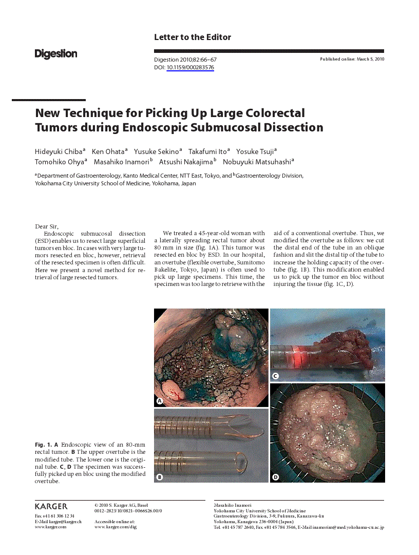 First page of New Technique for Picking Up Large Colorectal Tumors during Endoscopic Submucosal Dissection