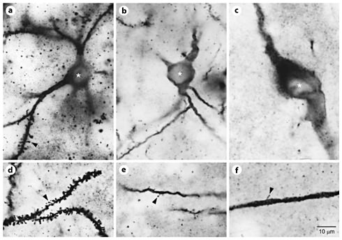 Fig. 4. Photomicrographic series (100× oil immersion planoapochromatic objective, n.a. = 1.3, brightfield transmission illumination) demonstrating somatodendritic characteristics of the 3 phenotypes of TI + GG neurons in adult feline neostriatum. a–c Doubly labeled cell bodies are shown by asterisks, with somatodendritic TI + GG phenotypes (a medium spiny, b medium aspiny, c large aspiny) identified for each panel. d–f Dendritic spines on distal dendritic branches (orders >3) for each of the phenotypes listed above are shown by arrowheads. Scale = 10 µm.