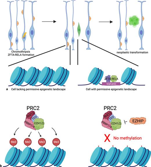 Pediatric brain cancers develop when oncogenic events happen in cells with a permissive epigenetic landscape. a Pediatric ST ependymomas develop when ZFTA-RELA works within the permissive epigenetic landscape of radial glia (blue cells) to induce oncogenic transcriptional programs. Chromothripsis happens in a blue RGC, leading to the formation of ZFTA-RELA. The fusion then keeps developmental transcriptional programs on to induce tumorigenesis (green cells), such as those induced by PLAGL1 which are usually turned off by birth in normal development. Cells without a permissive epigenetic landscape, such as the orange immature neurons, are not able to be transformed by the fusion protein. b When EZHIP is overexpressed in PFA, this leads to decreased H3K27me3 and subsequent oncogenic transcriptional changes.