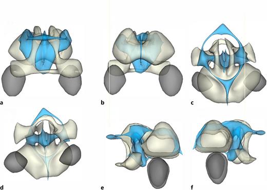 Segmentation. Three-dimensional insight into the E25 rabbit fetal brain using segmentation editor of 3D Slicer. Sequential perspectives are depicted for the posterior (a), anterior (b), superior (c), inferior (d), right (e), and left (f) orientations. Segmentation editor tools in 3D Slicer were harnessed to meticulously delineate brain tissue (white), fluid (blue), and ocular structures (gray). Employing T2-weighted axial MRI images tailored to each slice of the fetal brain, the segmentation process highlighted dark regions as brain tissue and bright regions as fluid.