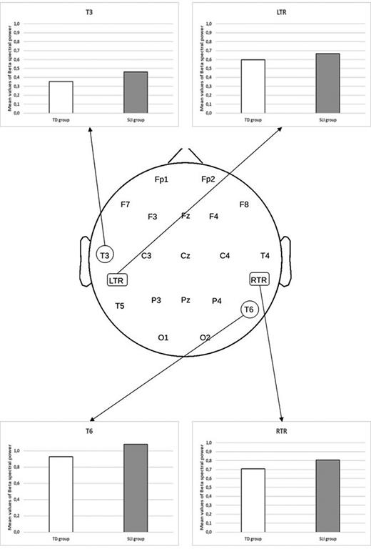 Graphs showing descriptive statistically significant group effects in beta SP during the auditory listening task. TD, typical development; SLI, specific language impairment; LTR, left temporal region; RTR, right temporal region.