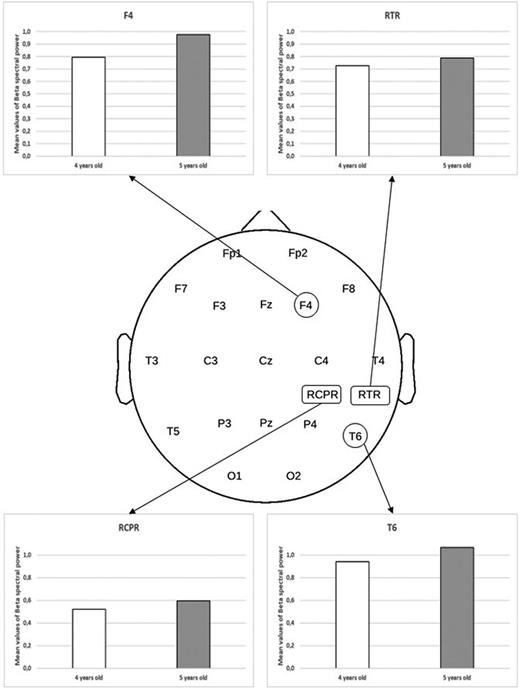 Graphs showing descriptive statistically significant age group effects in beta SP during the auditory listening task. TD, typical development; SLI, specific language impairment; RTR, right temporal region; RCPR, right centroparietal region.