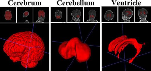 Cerebrum, cerebellum, and ventricle. Digitally labelled segments of the brain by cerebrum, cerebellum, and ventricle. Each segment was manually delineated and segmented. After the segmentation, smoothing was processed.