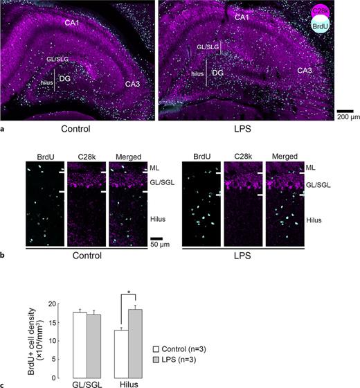 Immunofluorescence images for calbindin D28k with BrdU-labeling and BrdU-labeled cell density in dorsal hippocampus of LPS-exposed and control ferrets on postnatal day 7. a Low magnification images of calbindin D28k (C28k) immunofluorescence with BrdU labeling in the dorsal hippocampus at the coronal plane in control (left) and LPS-exposed (right) ferrets. Note that the sectional plane of LPS-exposed ferrets is slightly posterior to that in controls. b High magnification images of C28k immunofluorescence with BrdU labeling in the DG of the dorsal hippocampus in control (left) and LPS-exposed (right) ferrets. No BrdU labeling appeared in C28k-immunopositive granular neurons. ML, molecular layer; GL/SGL, granular and subgranular layers. c Bar graph of BrdU-labeled cell density. Data are shown as means ± standard deviations. Significance is indicated using Scheffé’s test at *p < 0.001.