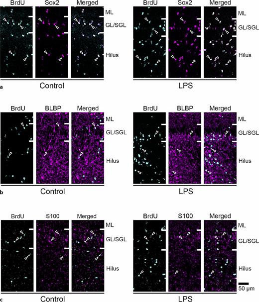 Immunofluorescence images for Sox2, BLBP, and S100 with BrdU labeling in dorsal hippocampus of LPS-exposed and control ferrets on postnatal day 7. a High magnification images of Sox2 immunofluorescence with BrdU labeling in the DG of the dorsal hippocampus in control (left) and LPS-exposed (right) ferrets. Open arrowheads indicate BrdU-labeled Sox2-immunopositive progenitors. b High magnification images of BLBP immunofluorescence with BrdU labeling in the DG of the dorsal hippocampus in control (left) and LPS-exposed (right) ferrets. Open arrowheads indicate BrdU-labeled BLBP-immunopositive progenitors. c High magnification images of S100 immunofluorescence with BrdU labeling in the DG of the dorsal hippocampus in control (left) and LPS-exposed (right) ferrets. Open arrowheads indicate BrdU-labeled S100-immunopositive cells. ML, molecular layer; GL/SGL, granular and subgranular layers.