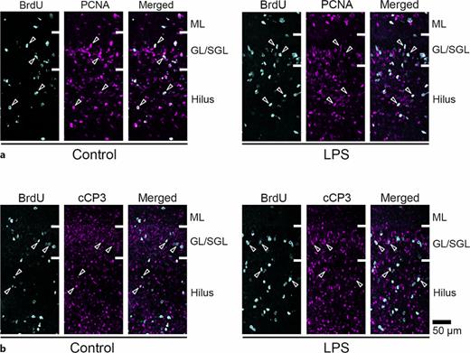 Immunofluorescence images for PCNA and cleaved caspase 3 with BrdU labeling in dorsal hippocampus of LPS-exposed and control ferrets on postnatal day 7. a High magnification images of PCNA immunofluorescence with BrdU labeling in the DG of the dorsal hippocampus in control (left) and LPS-exposed (right) ferrets. Open arrowheads indicate BrdU-labeled PCNA-immunopositive cells. b High magnification images of cleaved caspase 3 (cCP3) immunofluorescence with BrdU labeling in the DG of the dorsal hippocampus in control (left) and LPS-exposed (right) ferrets. Open arrowheads indicate BrdU-labeled cCP3-immunopositive cells. ML, molecular layer; GL/SGL, granular and subgranular layers.