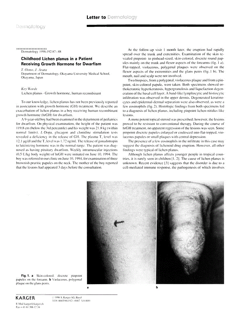 First page of Childhood Lichen planus in a Patient Receiving Growth Hormone for Dwarfism
