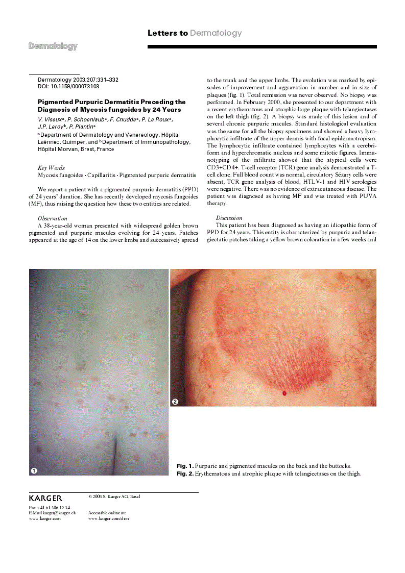 Pigmented Purpuric Dermatitis Preceding the Diagnosis of Mycosis ...
