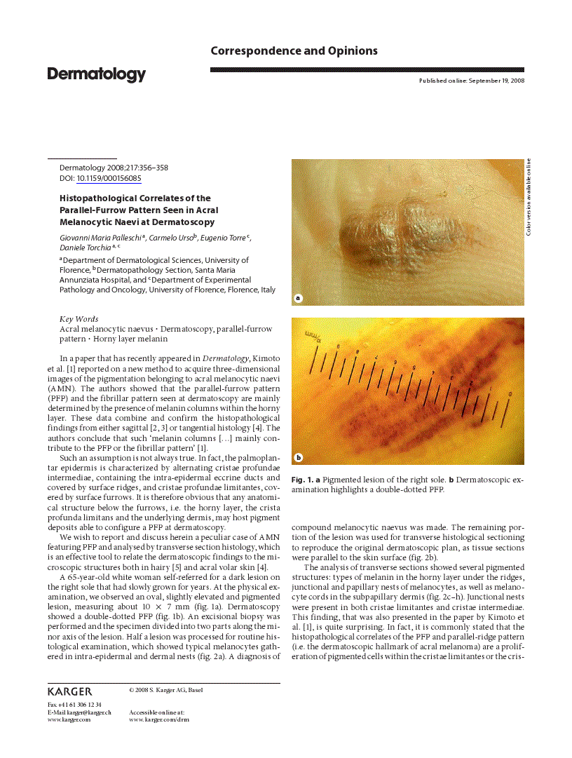 Histopathological Correlates of the Parallel-Furrow Pattern Seen in ...