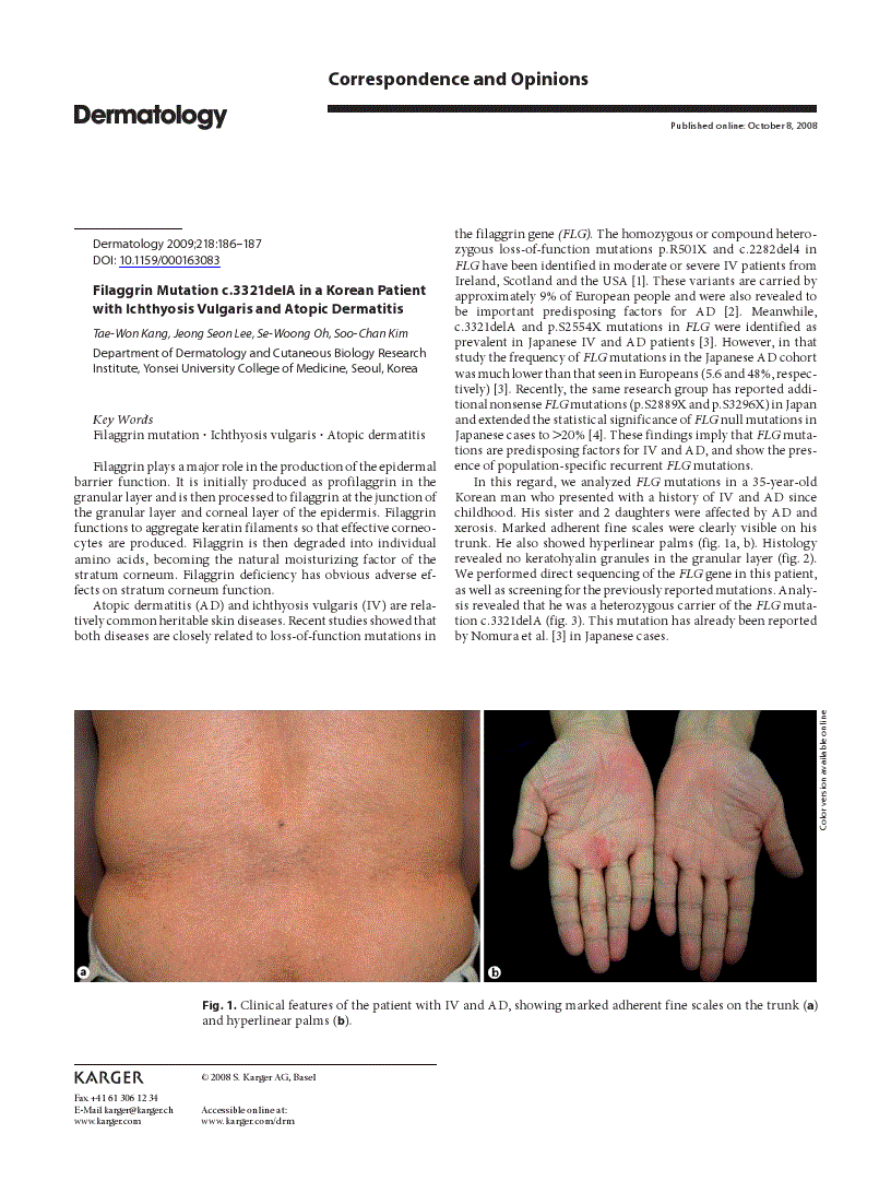 First page of Filaggrin Mutation c.3321delA in a Korean Patient with Ichthyosis Vulgaris and Atopic Dermatitis