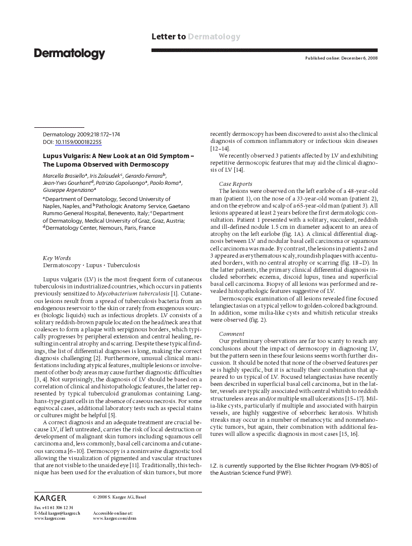 First page of Lupus Vulgaris: A New Look at an Old Symptom – The Lupoma Observed with Dermoscopy