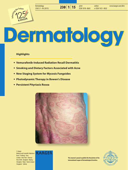 LongTerm Efficacy, Safety and Drug Survival of Ustekinumab in a