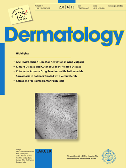 Reflectance Confocal Microscopy Features of Focal Dermal Mucinosis