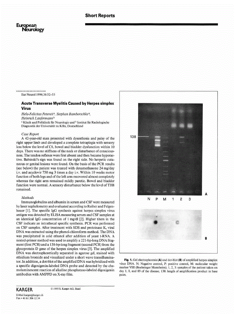 Acute Transverse Myelitis Caused by Herpes simplex Virus European