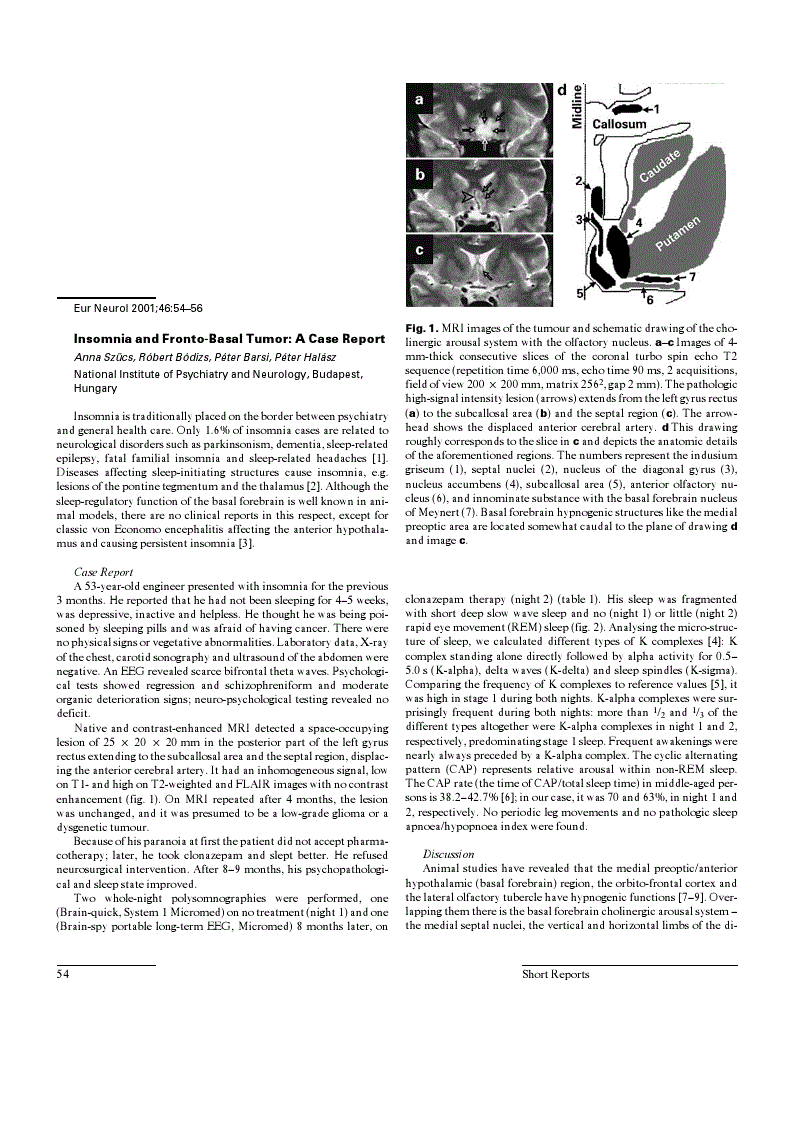 Insomnia and FrontoBasal Tumor A Case Report European Neurology