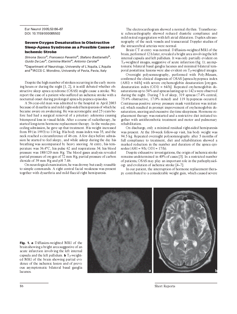 First page of Severe Oxygen Desaturation in Obstructive Sleep-Apnea Syndrome as a Possible Cause of Ischemic Stroke