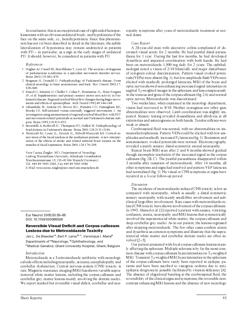 First page of Reversible Visual Deficit and Corpus callosum Lesions due to Metronidazole Toxicity