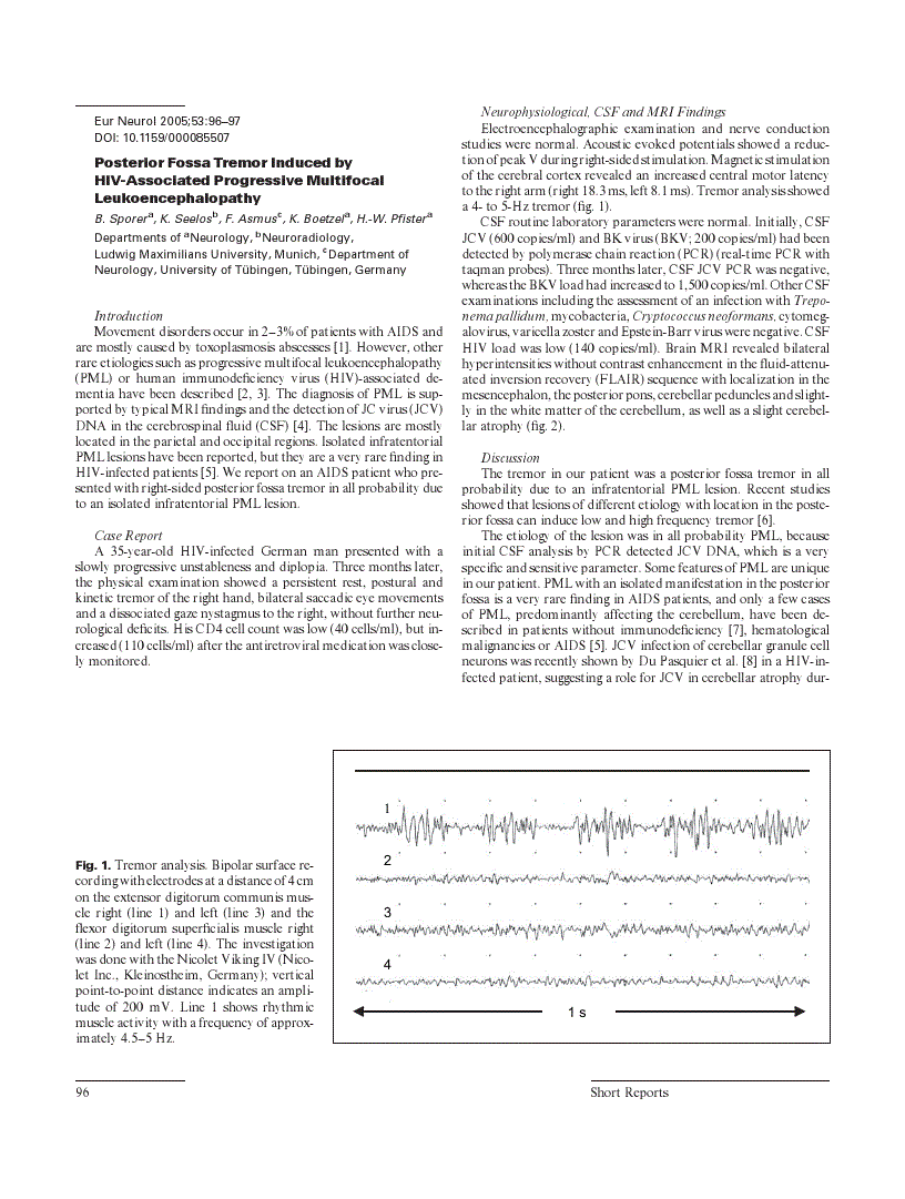 First page of Posterior Fossa Tremor Induced by HIV-Associated Progressive Multifocal Leukoencephalopathy