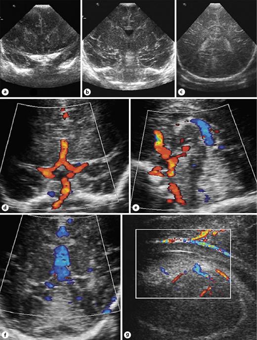 Methods for Monitoring Risk of Hypoxic Damage in Fetal and Neonatal