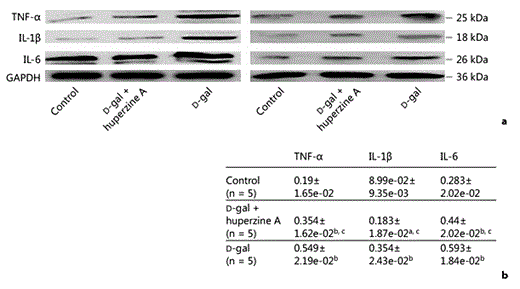 Huperzine A blocks the D-gal-induced increase in proinflammatory cytokines TNF-α, IL-1β and IL-6 in protein levels in the rat hippocampus. a Western blotting of 2 representative bands out of 3 different consistent experiments. As shown, samples were normalized by incubating membranes in the presence of GAPDH antibody. b Densitometric analysis performed on 3 different consistent experiments. These protein bands were significantly increased in the D-gal group compared with both the saline-treated control group and D-gal + huperzine A group (n = 5). Significant changes in the protein levels of TNF-α, IL-1β and IL-6 were also observed between the saline-treated control and D-gal + huperzine A groups. All of the data were presented as the mean ± SEM. a p < 0.01 and b p < 0.001 versus the saline-treated control group; c p < 0.001 versus the D-gal-treated group.