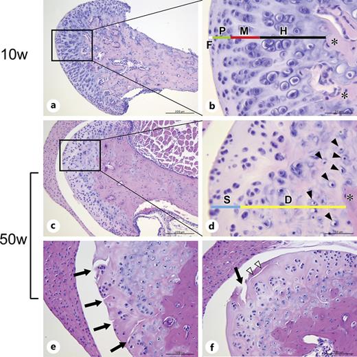 Frontal sections of the mandibular condyle stained with hematoxylin and eosin. a, b Chondrocytes were well organized and arranged in columns, and four zones were observed in the MCC of 10-week-old mice. F, fibrous zone; P, proliferative zone; M, mature zone; H, hypertrophic zone; asterisks, subchondral bone. c, d The arrangement of chondrocytes was disorganized, their cellularity was decreased, and only two zones were observed in the MCC of 50-week-old mice. Chondrocytes with a small nucleus and light cytoplasm (arrowheads) were seen on the subchondral bone side of the deep zone. S, superficial zone; D, deep zone; asterisks, subchondral bone. e, f Some clefts (arrows) and detachment (white arrowheads) were observed on the surface of the aged MCC. Scale bars = 200 μm in a, c; 50 μm in b, d; 100 μm in e, f.