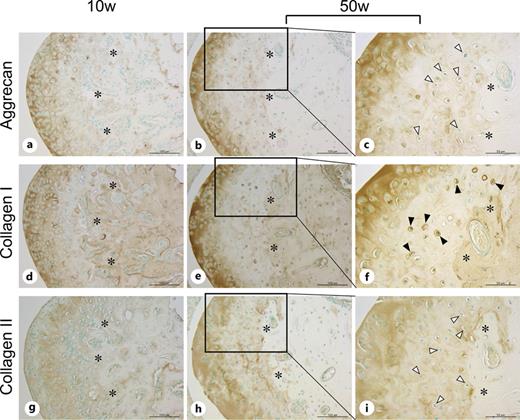 Immunohistochemical staining for the expression of ECM proteins in the MCC. a, b Immunolocalization of aggrecan in 10- and 50-week-old mice. c Enlargement of the boxed area in b. Most chondrocytes with a small nucleus and light cytoplasm (white arrowheads) showed no immunoreactivity for aggrecan. d, e Immunolocalization of type I collagen in 10- and 50-week-old mice. f Enlargement of the boxed area in e. Intense immunoreactivity for type I collagen was observed in chondrocytes with a small nucleus and light cytoplasm (black arrowheads). g, h Immunolocalization of type II collagen in 10- and 50-week-old mice. i Enlargement of the boxed area in h. Almost all chondrocytes with a small nucleus and light cytoplasm (white arrowheads) showed no immunoreactivity for type II collagen. Asterisks, subchondral bone. Scale bars = 100 μm in a, b, d, e, g, h; 50 μm in c, f, i.