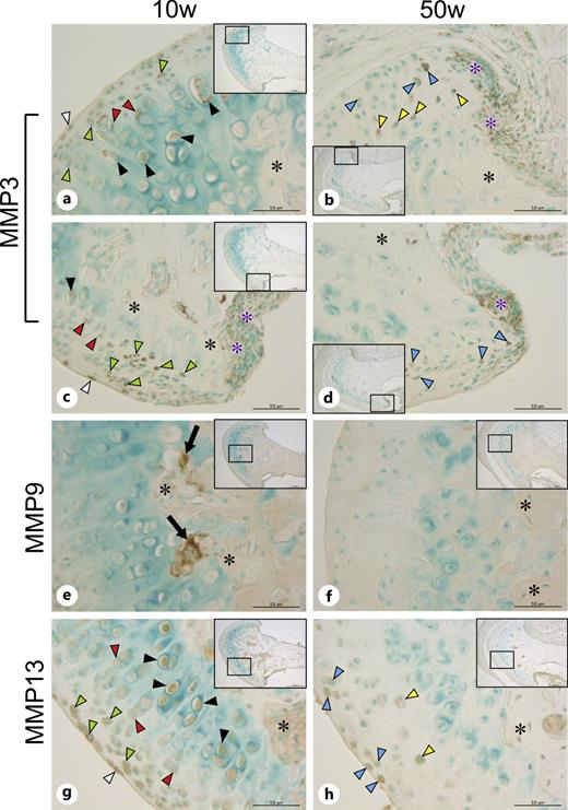 Immunohistochemical staining for the expression of matrix metalloproteinases (MMPs) in the MCC. a, c MMP-3 immunoreactivity was seen in the cells in the fibrous (white arrowheads), proliferative (green arrowheads), mature (red arrowheads), and hypertrophic zones (black arrowheads) in 10-week-old mice. b, d MMP-3 immunoreactivity was seen in the cells in the superficial (blue arrowheads) and deep zones (yellow arrowheads) in 50-week-old mice. b–d Synovial membrane cells around the condylar neck (purple asterisks) showed immunoreactivity for MMP-3 in both 10- and 50-week-old mice. e MMP-9 immunoreactivity was observed in large multinucleated cells (arrows) at the interface between the MCC and subchondral bone. f No MMP-9 immunoreactivity was detected in 50-week-old mice. g MMP-13 immunoreactivity was seen in the cells in the fibrous (white arrowheads), proliferative (green arrowheads), mature (red arrowheads), and hypertrophic zones (black arrowheads) in 10-week-old mice. h MMP-13 immunoreactivity was seen in the cells in the superficial (blue arrowheads) and deep zones (yellow arrowheads) in 50-week-old mice. Asterisks, subchondral bone. Scale bars = 50 μm.