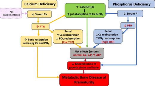 Ca and PO4 homeostasis in MBDP. There is a complex interplay among 1,25(OH)2D, PTH, and fibroblast growth factor 23 (FGF23) to maintain mineral homeostasis [69]. Phosphorus deficiency leads to low FGF 23 levels (mechanism not completely understood) which causes increased 1,25(OH)2D production, resulting in increased absorption of both Ca and phosphorus from the gut and increased phosphorus reabsorption from the kidneys. This is in contrast to conditions with FGF-23-mediated hypophosphatemia (like X-linked hypophosphatemic rickets) which have elevated FGF 23 levels causing decreased 1,25(OH)2D production. In primary Ca and/or vitamin D deficiency, PTH level increases which activates 25OHD to 1,25(OH)2D which in turns increases absorption of Ca and phosphorus from gut. Elevated PTH also increases bone resorption with release of Ca and phosphorus as well as increases renal Ca reabsorption and renal phosphorus excretion. The net effect is normal serum Ca, low serum phosphorus, and elevated ALP level. All the above lead to decreased mineralization of growth plate and bone, resulting in MBDP. Since the serum chemistry panel can be similar in both Ca and PO4 deficiency states, if PO4 is supplemented alone in a Ca deficiency state, it can exacerbate hyperparathyroidism and cause further bone resorption. Hence, it is important to understand the pathophysiology to treat appropriately. ALP, alkaline phosphatase; Ca, calcium; P, phosphorus; PO4, phosphate; PTH, parathyroid hormone; TPN, total parenteral nutrition; TRP, tubular reabsorption of phosphate; 1,25(OH)2D, 1,25 dihydroxy vitamin D.