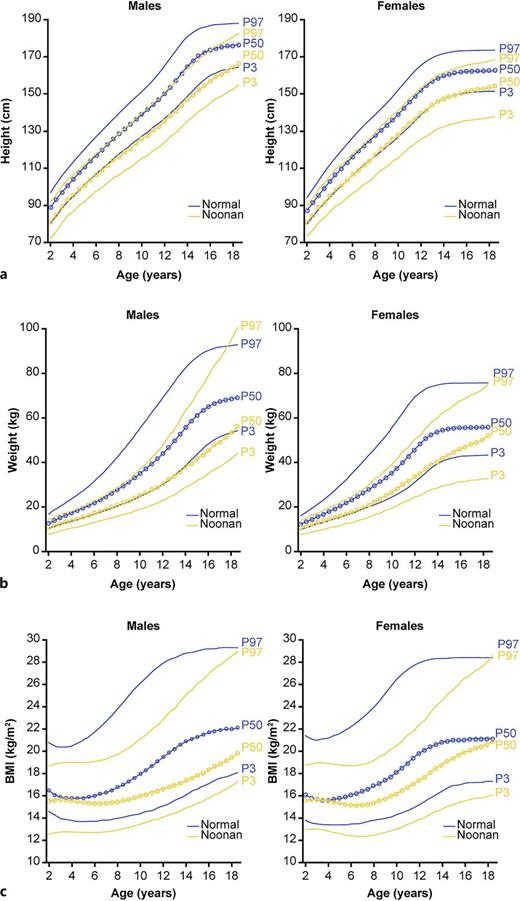 Sex-specific centile curves for individuals with NS versus normal curves for the Italian population derived from Cacciari et al. [54] for height (a), weight (b), and body mass index (BMI) (c). “P” values represent percentiles. Figure reproduced and adapted with permission from Cacciari E, Milani S, Balsamo A, Spada E, Bona G, Cavallo L, Cerutti F, Gargantini L, Greggio N, Tonini G, Cicognani A. Italian cross-sectional growth charts for height, weight and BMI (2 to 20 yr). J Endocrinol Invest 2006;29(7):581–93, Springer Nature.