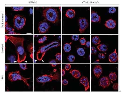 Fig. 6. Shape changes are altered in CD2-IL-5/rac2–/– eosinophils during chemoattractant stimulation. a Cells were stained with fluorescent F-actin-binding rhodamine-phalloidin (red), and counterstained with the nuclear stain DAPI (blue), following stimulation for 10 s with eotaxin-2 (10 ng/ml) or PAF (10 nM). Arrowheads indicate intense deposition of F-actin at the leading edges of migrating cells. Scale bar = 10 µM. b Frequency plots showing morphologically round and stretched cell shapes in eosinophils stimulated with eotaxin and PAF. Quantitation of cells was done from 7 to 11 high-powered fields taken from a 63× objective.