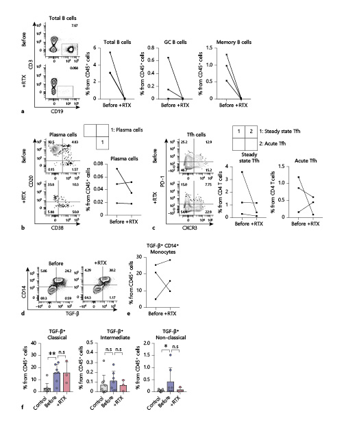 Fig. 2. RTX treatment did not alter plasma cells and TGF-β-secreting CD14+ monocytes from the PBMCs of IgG4-RD patients. a Frequencies of total B cells (CD19+), GC B cells (CD19+CD20+CD38+), and memory B cells (CD19+CD27+CD38−) from PBMCs were compared before and after RTX treatment. b, c The representative dot plot and percentage of plasma cells (b) and Thf (c) before and after RTX treatment. d, e Representative dot plot (d) and percentage of TGF-β-producing monocytes (e)before and after RTX treatment. f TGF-β-producing monocytes were further divided by CD14 and CD16 expression. Classical (CD14++CD16−), intermediate (CD14++CD16+), and nonclassical monocytes (CD14+CD16+) were analyzed. Values represent the mean ± SD. Wilcoxon matched-pairs signed rank test was used to compare before and after RTX-treated patients (a–c, e). Mann-Whitney test was used to compare control and IgG4-RD or before and after RTX-treated groups (f). *p < 0.05, **p < 0.01. ns, not significant; IgG4-RD, immunoglobulin G4-related disease; RTX, rituximab; Tfh, follicular helper T; PBMCs, peripheral blood mononuclear cells.