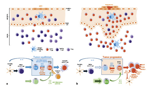 Fig. 1. Immune responses in early- and advanced-stage CTCL. a Early-stage CTCL. Upper panel: schematic illustration of the cellular composition in patch-stage disease. Small populations of tumor T cells are present mostly in the epidermis and are held in check by surrounding healthy T cells and regulatory T cells. Lower panel: immunosurveillance mechanisms are partially intact, the antitumor Th1 immune response can control tumor progression, leading to a tumor equilibrium. b Advanced-stage CTCL. Upper panel: schematic illustration of the cellular composition in plaque/tumor stage disease. The number of infiltrating tumor T cells is largely increased and present now also in the dermis, while the number of healthy T cells and T regulatory cells is decreased. Lower panel: immunosurveillance of the tumor is largely defective. A skewed Th1 immune response and an increased Th2 response, among other mechanisms, lead to immune escape of tumor cells and allow tumor progression.