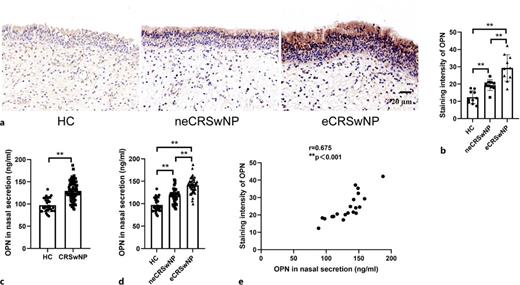 OPN levels in nasal secretion and tissues of CRSwNP. a, b The staining intensity of OPN was detected by immunohistochemistry. n = 10 for each group. c OPN concentrations in nasal secretions in the HC and CRSwNP groups. n = 32 for HC group, n = 81 for CRSwNP group. d OPN concentrations in nasal secretions in the HC and CRSwNP groups. n = 32 for HC group, n = 37 for neCRSwNP group, n = 44 for neCRSwNP group. e Pearson correlation analysis was used to analyze the correlation between OPN in nasal secretions and OPN in tissues. n = 20 for CRSwNP group, including n = 10 for neCRSwNP group and n = 10 for neCRSwNP group. The multiple groups were analyzed by one-way ANOVA followed by post hoc Tukey’s tests for multiple comparisons, while an unpaired Student’s t test was utilized for binary comparisons. **p < 0.01.