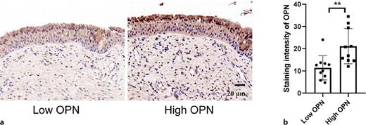 High concentration of OPN in nasal secretions suggests high expression of OPN in tissues. a, b The staining intensity of OPN was detected by immunohistochemistry. Unpaired Student’s t test was utilized for binary comparisons. n = 10 for each group. **p < 0.01.