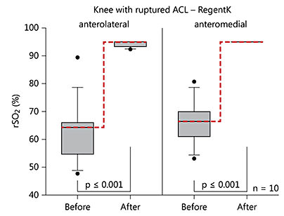 Fig. 1. Box plot of changes in rSO2 on the injured knee after RegentK (ends of boxes: 25th and 75th percentiles; line at the median; error bars: 10th and 90th percentiles).