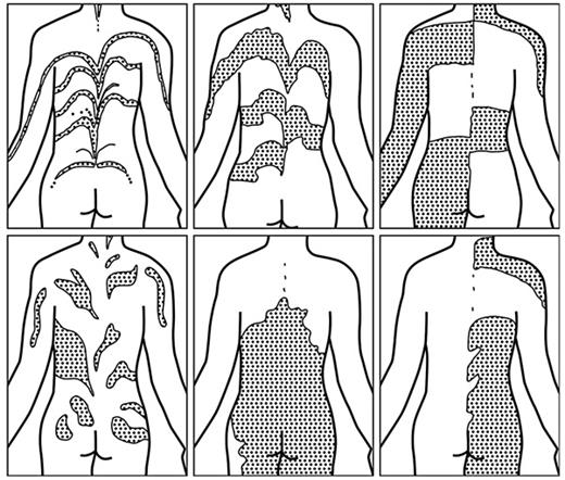 The Puzzle of the Skin Patterns | Integrative Medicine International ...