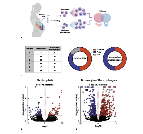 Fig. 2. Transcriptomic differences between amniotic fluid neutrophils and monocytes/macrophages of predominantly fetal or maternal origin. a Experimental design demonstrating the transcriptomic comparison between amniotic fluid neutrophils or monocytes/macrophages of predominantly fetal and maternal origin. b Table and pie charts representing the maternal (neutrophils, n = 4; monocytes/macrophages, n = 3) or fetal (neutrophils, n = 2; monocytes/macrophages n = 3) origins of amniotic fluid neutrophils and monocytes/macrophages determined using DNA fingerprinting. c, d Volcano plots showing the differentially expressed genes among amniotic fluid neutrophils (c) and monocytes/macrophages (d) of fetal origin compared to those of maternal origin. M, predominantly maternal origin; F, predominantly fetal origin; FC, fold change.