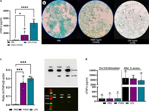 TLR stimulation of BMDMs upregulates both bioactive forms of TNF. a Soluble TNF was quantified from immortalized WT BMDM cellular supernatants after stimulation for 12 h with either 1 μg/mL PAM2, LPS, or equal volume PBS by ELISA. Results were obtained from 4 independent experiments. ELISAs had a minimum of 2 technical replicates for each sample. Each data point represents the averaged technical replicate in each experiment. Statistical analysis was performed with one-way ANOVA. *p = 0.0485, ****p ≤ 0.0001. b tmTNF protein visualized by immunocytochemistry (brown staining indicates tmTNFα; black arrows). Immunocytochemistry pictures were obtained from different experiments. c The tmTNF quantified by Western blot and presented as the ratio of tmTNF over reference protein β-actin using AzureSpot Pro software. Western blot ratios were calculated from 3 independent experiments; however, Western blot band data shown (right) is from one representative experiment. Statistical analysis was performed with one-way ANOVA ***p = 0.0008. d The sTNF protein was quantified from immortalized WT BMDM supernatant before TLR stimulation (pre-TLR stimulation; left) and after infection with S. aureus for 5 h (after S. aureus; right) by ELISA. Results were obtained from three independent experiments which included 3 technical replicates each. Each data point represents the average of 3 technical replicates. Data in “Pre-TLR Stimulation” condition were obtained from separate experiments than data in “After S. aureus” condition.