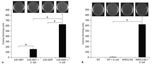 Fig. 4. Deficiency of NFATc3 results in attenuated bactericidal activity. a WT macrophages were treated with 11R-VIVIT (specific NFAT inhibitor) and incubated with E. coli, and bactericidal activity was analyzed by plating macrophage lysate on bacterial culture plates. The NFAT inhibitor-treated macrophages had attenuated bactericidal activity compared to the group treated with control peptide (11R-VEET). b Macrophages cultured from WT and NFATc3 KO mice were treated with E. coli, and bactericidal activity was analyzed by plating macrophage lysate on bacterial culture plates. The NFATc3-deficient macrophages had significantly attenuated bactericidal activity compared to WT macrophages. Error bars represent the standard deviation. * p < 0.01. n = 3.