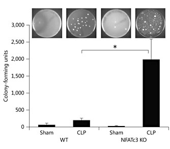 Fig. 5. Inhibition of NFATc3 results in bacterial infection in lungs during sepsis. The WT and NFATc3 KO mice were subjected to CLP. After 24 h the mice were euthanized, and bacterial infection in the lungs was assessed by plating lung homogenate on sheep blood agar plates. The NFATc3 KO mice subjected to sepsis by CLP had severe bacterial infection compared to WT mice. Error bars represent the standard deviation. * p < 0.01. n = 3.
