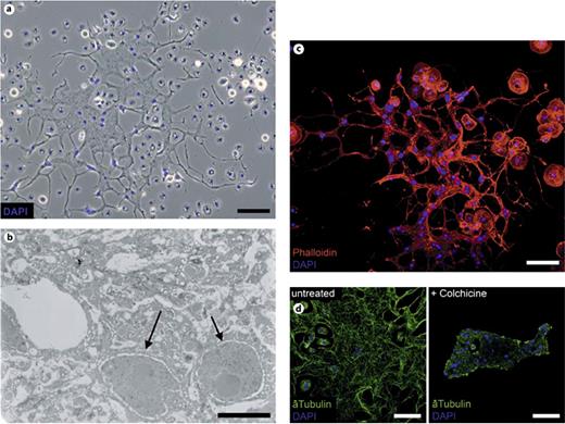 Fig. 1. Morphological analysis of MGHs. a Phase-contrast microscopic image of an MGH. b Transmission electron microscopic cross-section of an MGH. The arrows indicate the nuclei. c TRITC-phalloidin staining (red) of hemocytes from immune-induced D. ananassae larvae. d Anti-tubulin (green) and nuclear DAPI staining (blue) of the untreated and colchicine-treated MGHs of immune-induced larvae. Scale bars = 5 (b), 25 (d) and 50 μm (a, c; see online version for colors).