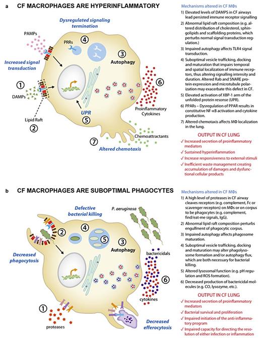 Fig. 1. A summary of abnormalities described in CF MΦs that lead to proinflammatory behavior (a) and suboptimal phagocytosis (b). Potential molecular mechanisms associated with these suboptimal performances are listed.