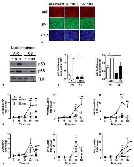 Fig. 8. CS impairs NF-κB transcriptional activity by ALI-PBEC. ALI-PBEC were left untreated or exposed to AIR or CS and stimulated with UV-inactivated NTHi for 1 h. a Cellular localization of the NF-κB subunits p50 and p65 was determined by immunofluorescence microscopy. The data shown represent n = 3 independent donors. b ALI-PBEC (n = 4) were exposed to AIR or CS and stimulated with 1 × 109 CFU/mL UV-inactivated NTHi for 1 h. Protein expression of p50 and p65 was measured in isolated nuclear extracts. c The data were quantified by densitometry. ALI-PBEC were unstimulated or exposed to AIR or CS and stimulated with 1 × 109 CFU/ml UV-inactivated NTHi for 1 h. ALI-PBEC (n = 4) were exposed to AIR or CS and subsequently stimulated with 1 × 109 CFU/mL UV-inactivated NTHi for 5, 15, 30, 60, and 120 min. mRNA expression of early induced NF-κB target genes NFKBIA, ZC3H12A, and NFKBIZ (d), and early induced MAPK-target genes JUN, FOS, and FOSL1 (e), was determined by qPCR. Data are shown as the fold change in mRNA compared to AIR-exposed cells. All results are shown as the mean ± SEM. Analysis of differences was conducted with a paired t test (c) and 2-way ANOVA with Bonferroni post hoc test (d, e). Significant differences compared to AIR: * p < 0.05, ** p < 0.01, *** p < 0.001. Significant differences compared to CS+NTHi: ##p < 0.01, ###p < 0.001.