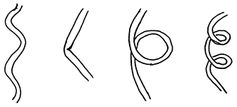 Twisted Blood Vessels: Symptoms, Etiology and Biomechanical Mechanisms ...
